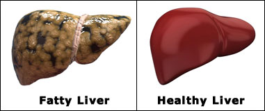 Faty and Healthy Liver