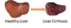 liver chirr